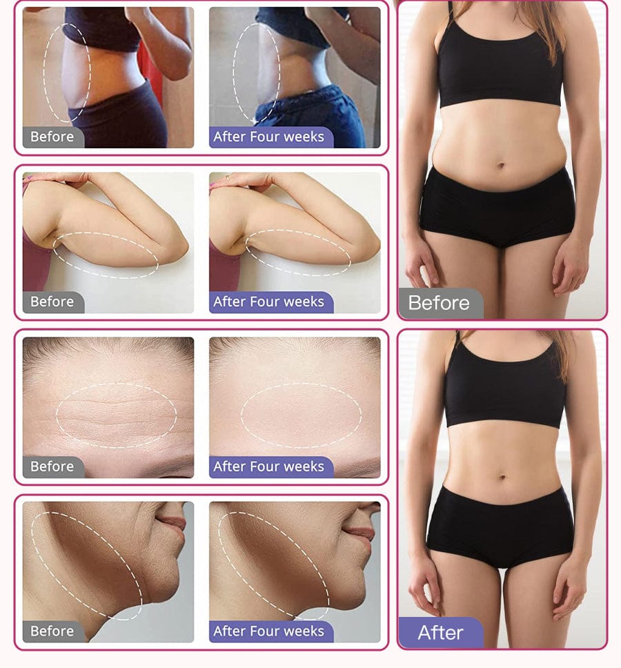 Before and after results of ultrasonic cavitation machine using