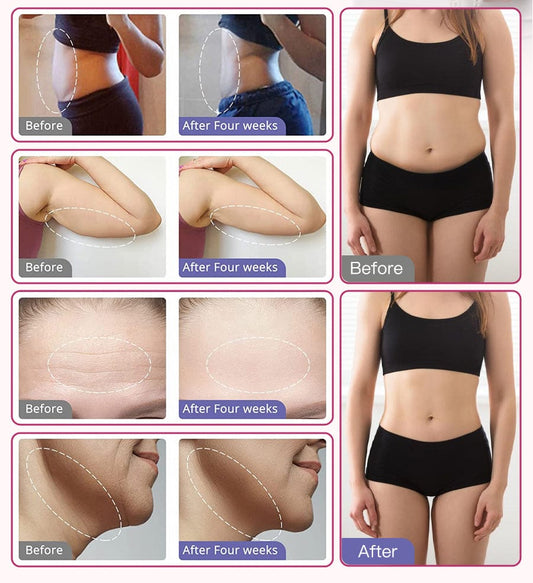 bornbyme Ultrasonic Cavitation Machine 80K Ultrasonic Cavitation Machine Anti Cellulite Fat Burners