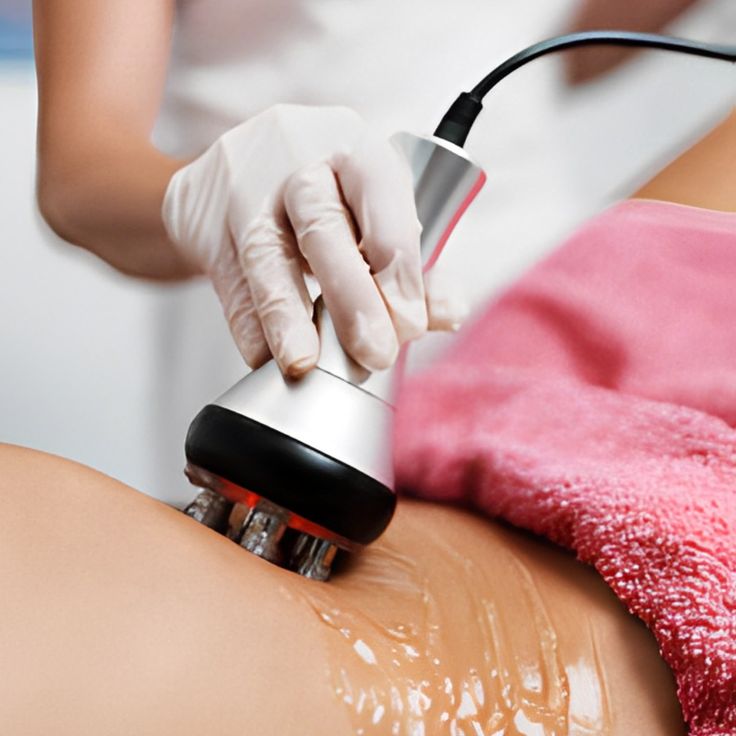 How to Choose Conductive Gel or Radio Frequency Gel for Radio Frequency?