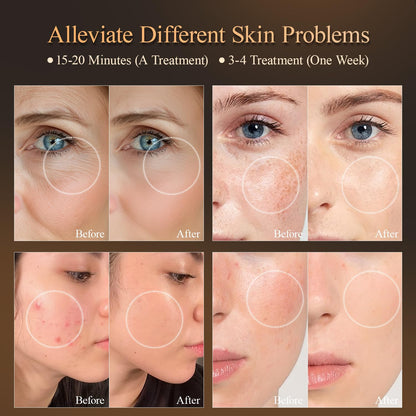 Red Light Therapy Mask use before after 