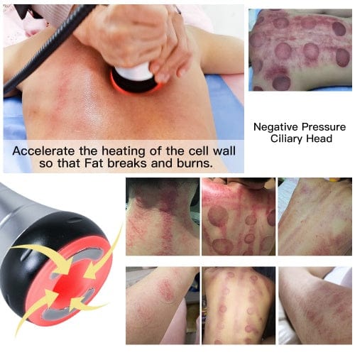 bornbyme Facial Massager Machine 40K Body Skin Tightening Lifting Cavitation Fat Burning Body Slimming Device