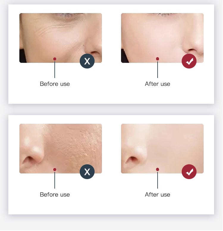 Bornbyme LED Light Therapy 7 Color LED Light Therapy for Face with Hydrating Spectrometer Plus 372 Light Beads