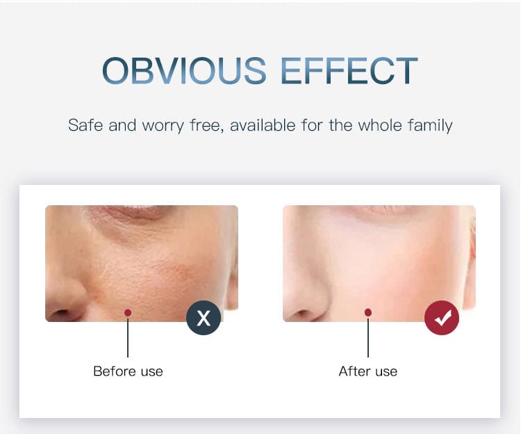 Bornbyme LED Light Therapy 7 Color LED Light Therapy for Face with Hydrating Spectrometer Plus 372 Light Beads