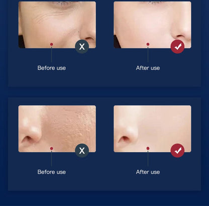 bornbyme LED Light Therapy 7 Color LED Light Therapy with Hydrating Nano Spray