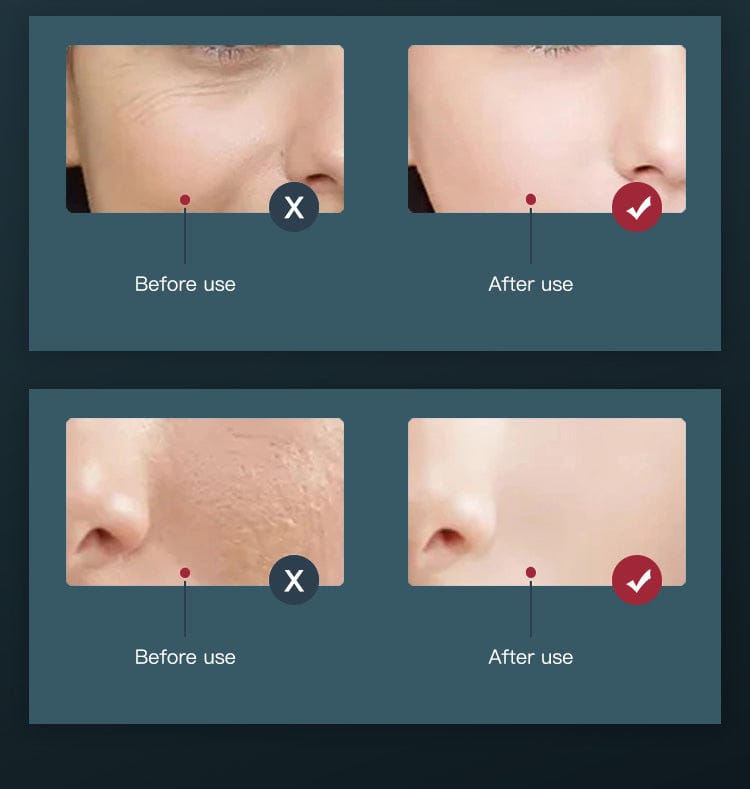 bornbyme LED Light Therapy 7 Color LED Light Therapy with Hydrating Spray