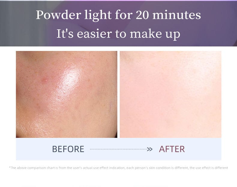 bornbyme LED Light Therapy LED Face Mask 3 Light Therapy for Face