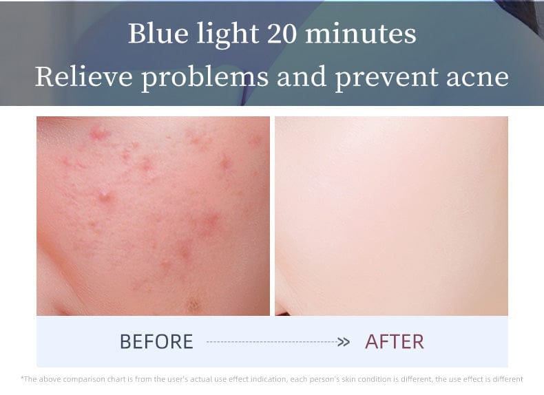 bornbyme LED Light Therapy LED Face Mask 3 Light Therapy for Face