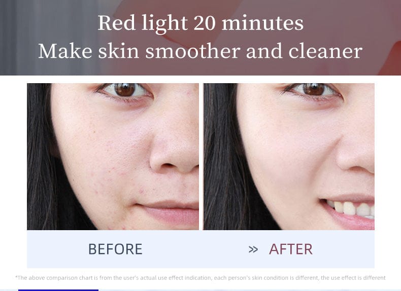 bornbyme LED Light Therapy LED Face Mask 3 Light Therapy for Face