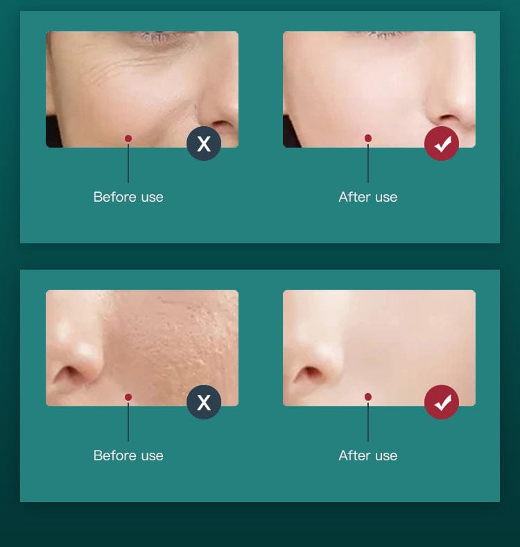 bornbyme LED Light Therapy LED Light Therapy with Hydrating Nano Spray & EMS Massager