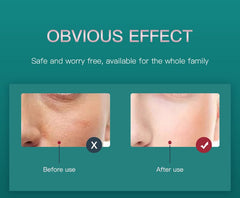 bornbyme LED Light Therapy LED Light Therapy with Hydrating Nano Spray & EMS Massager