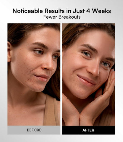 Bornbyme LED Light Therapy Red Light Therapy Mask for Face and Neck