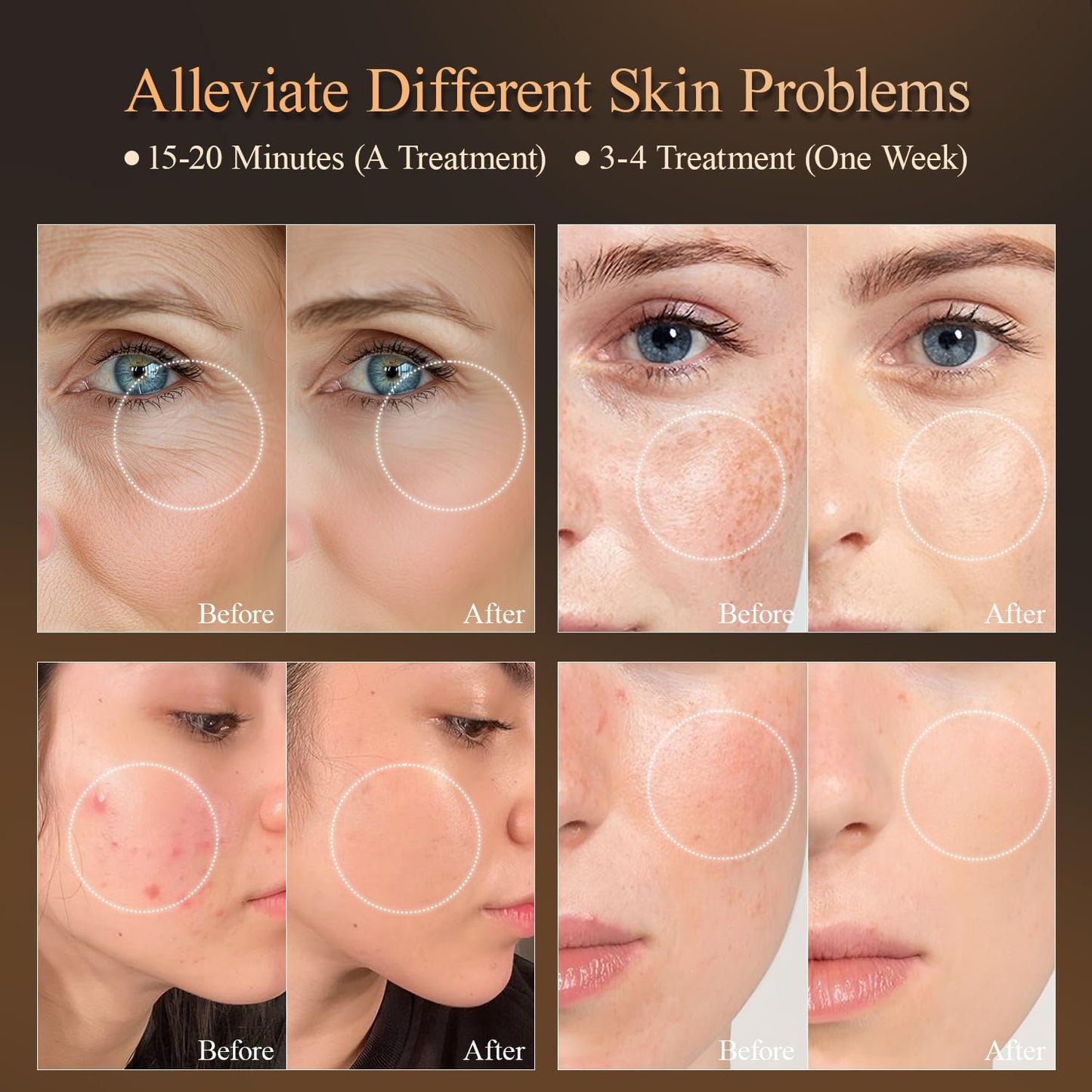 Bornbyme LED Light Therapy Red Light Therapy Mask for Face and Neck