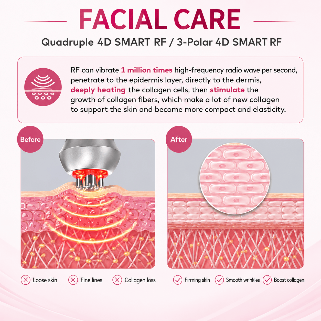 Bornbyme Ultrasonic Cavitation Machine 4 IN 1 80K Ultrasonic Cavitation RF Machine for Body Contouring & Skin Tightening