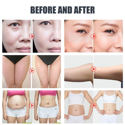Bornbyme Ultrasonic Cavitation Machine 40K 5-IN-1 Cavitation Anti Cellulite Body Shaping Device