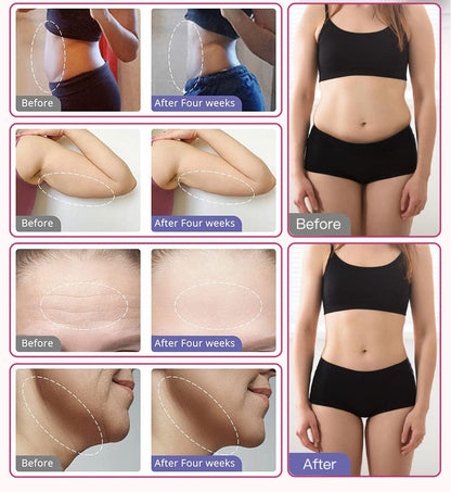 5 IN 1 80K Ultrasonic Cavitation Machine Anti Cellulite - Bornbyme Ultrasonic Cavitation Machine