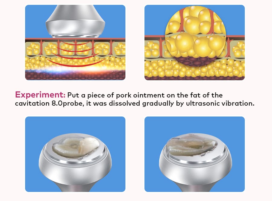 80K Ultrasonic Cavitation Machine Anti Cellulite Fat Burners - Bornbyme Ultrasonic Cavitation Machine