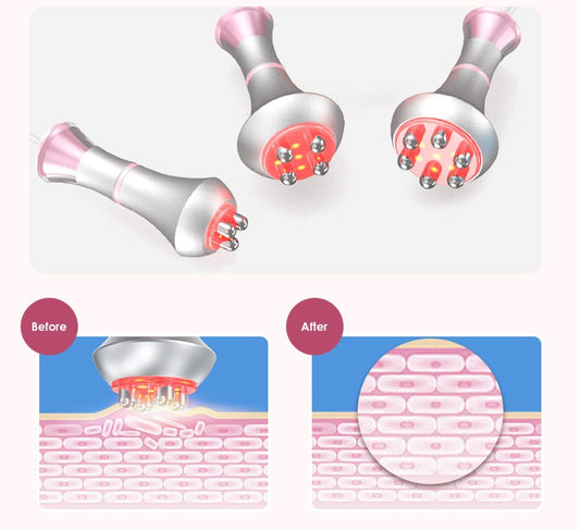80K Ultrasonic Cavitation Machine Anti Cellulite Fat Burners - Bornbyme Ultrasonic Cavitation Machine