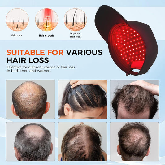 red light therapy hat for scalp treatments