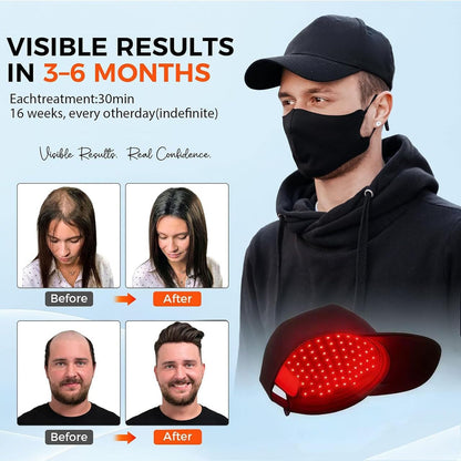 red light therapy hat use before after