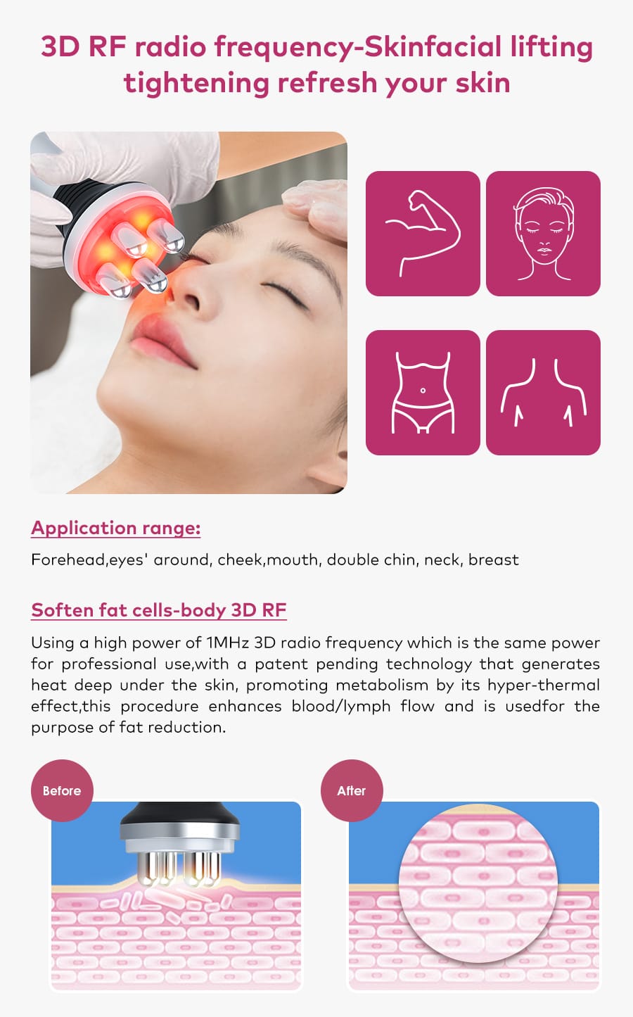 rf skin tightening machine for face 